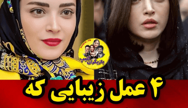 4 عمل زیبایی که بهنوش طباطبایی انجام داده! + عکس