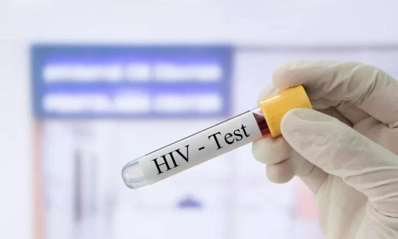 راه های تشخیص ایدز بدون آزمایش چیه؟ / با این روش ها تشخیص بده ایدز داری یا نه!